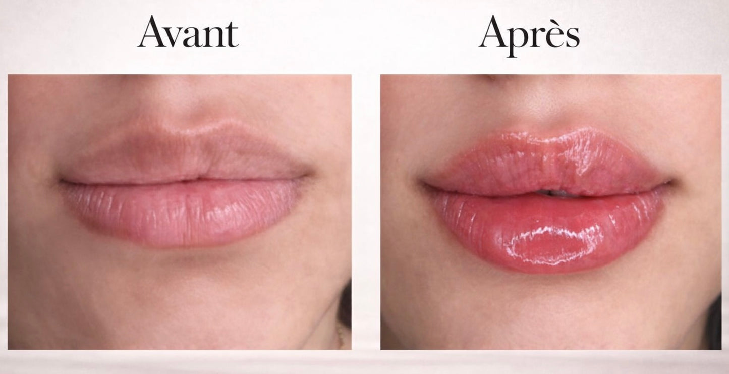 Glow Plump - Lip Volumizer
